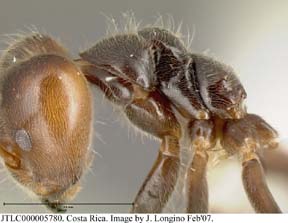 worker lateral view